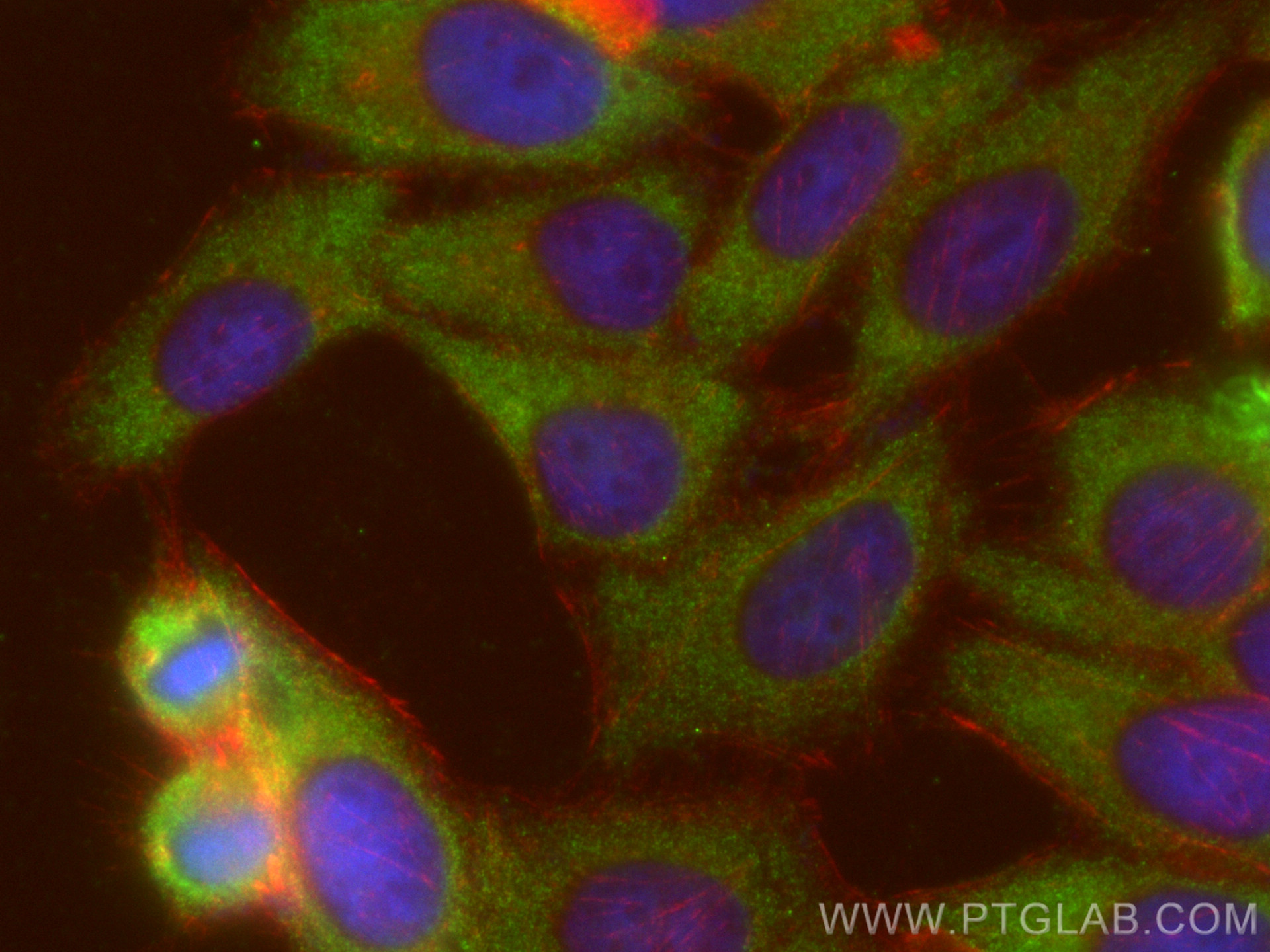 IF Staining of HepG2 using 10819-1-AP