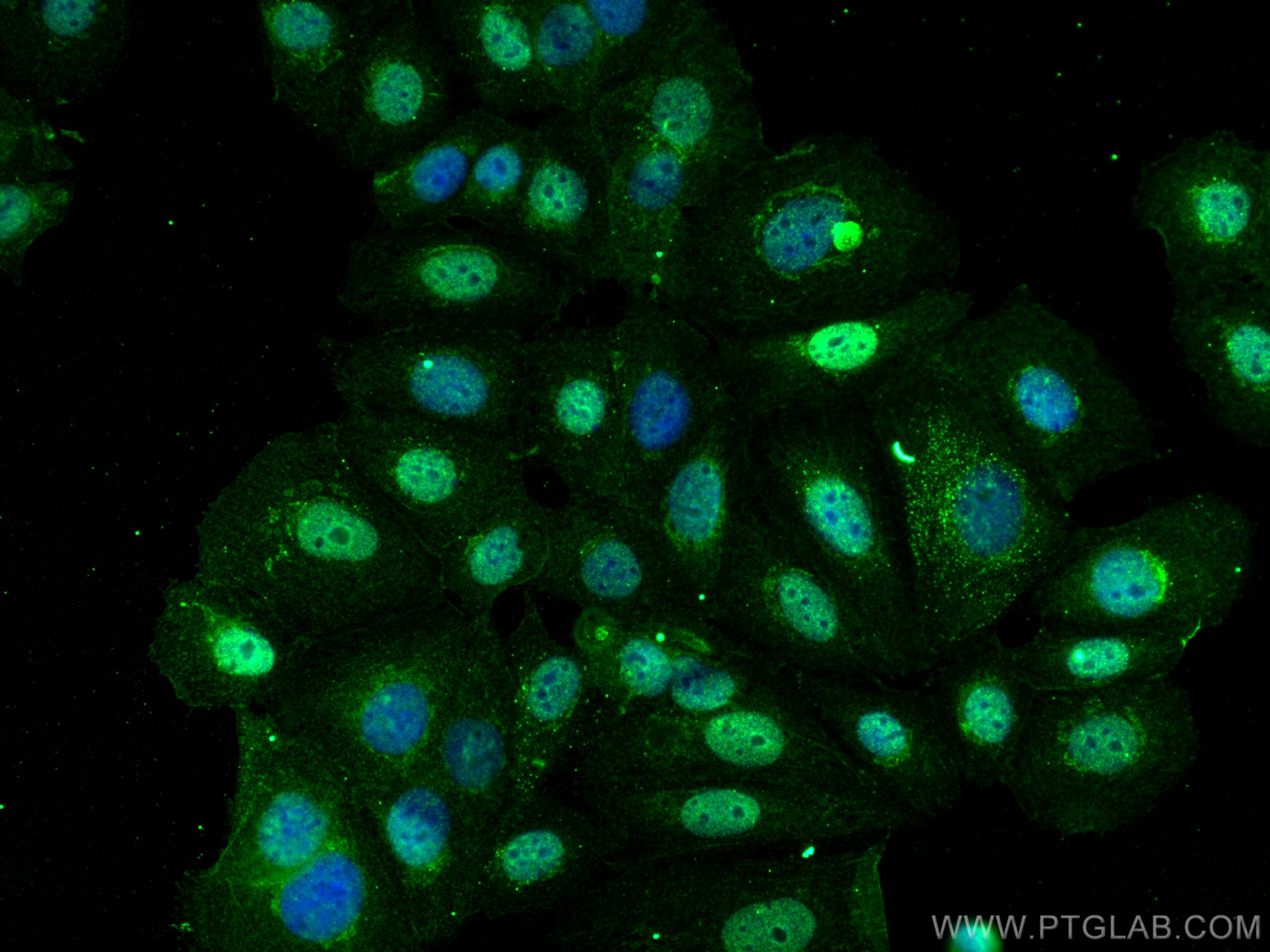 IF Staining of MCF-7 using 66870-1-Ig (same clone as 66870-1-PBS)