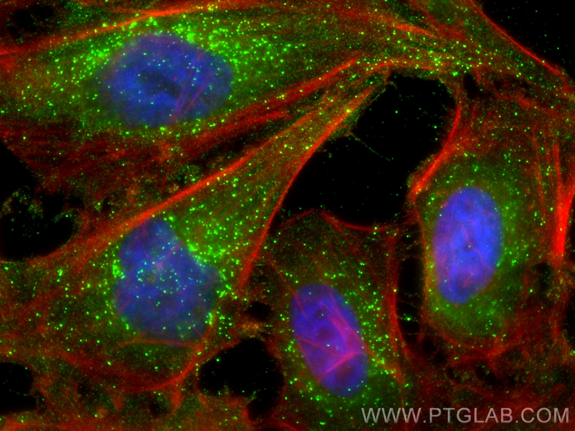 IF Staining of HeLa using 66870-1-Ig (same clone as 66870-1-PBS)