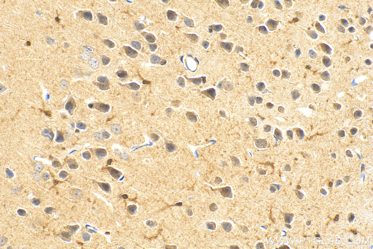 IHC staining of mouse brain using 28050-1-AP