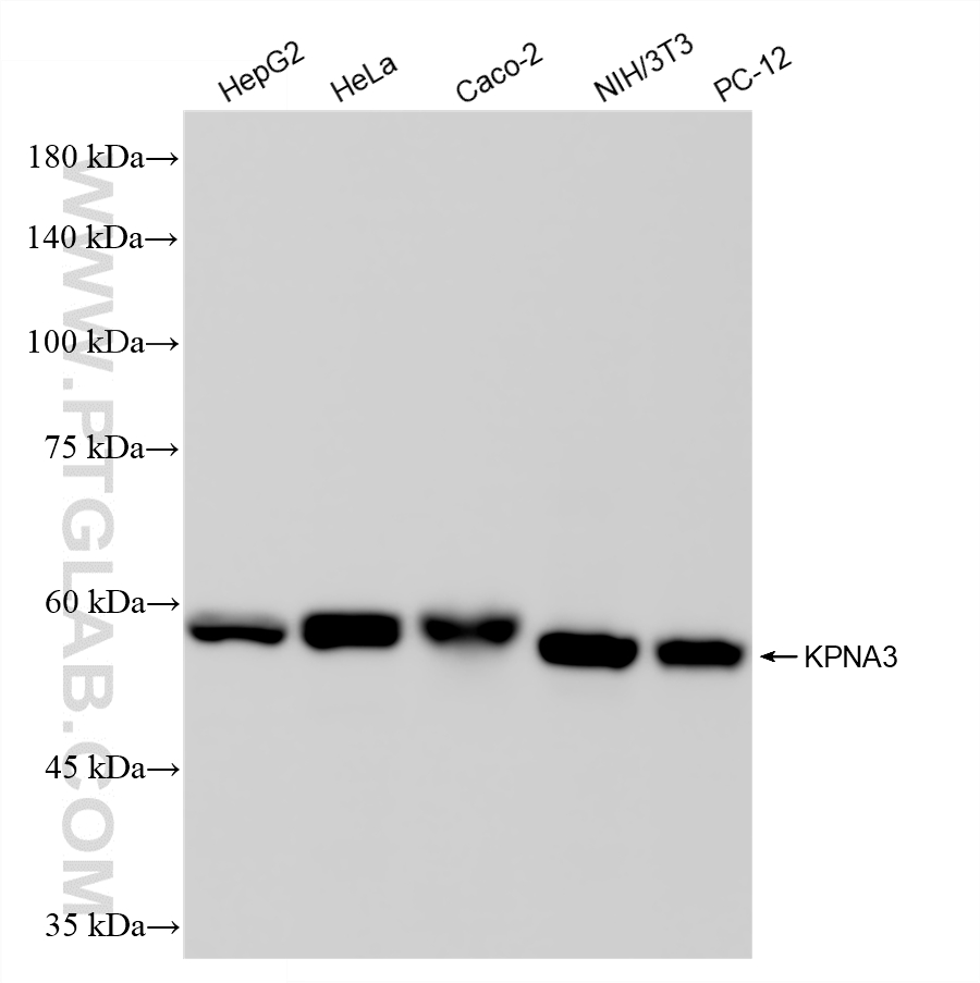 WB analysis using 86722-1-RR
