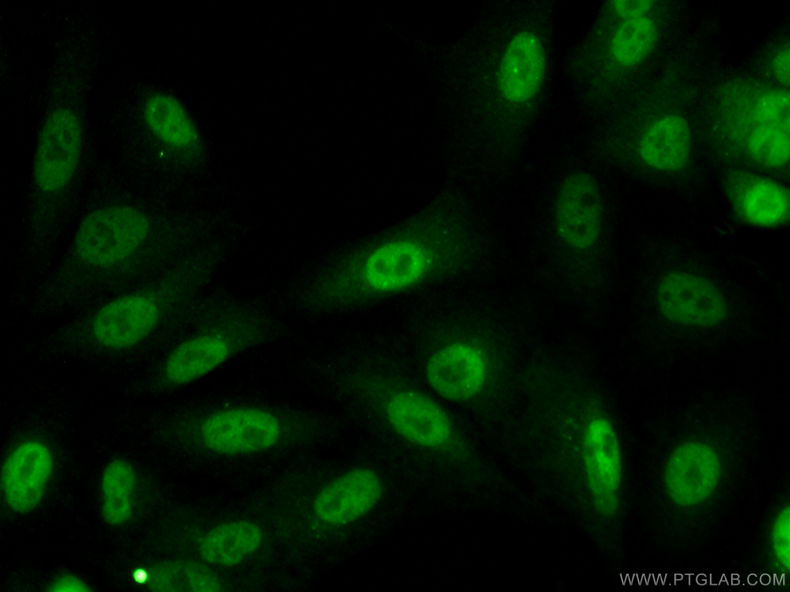 IF Staining of A549 using 12463-1-AP