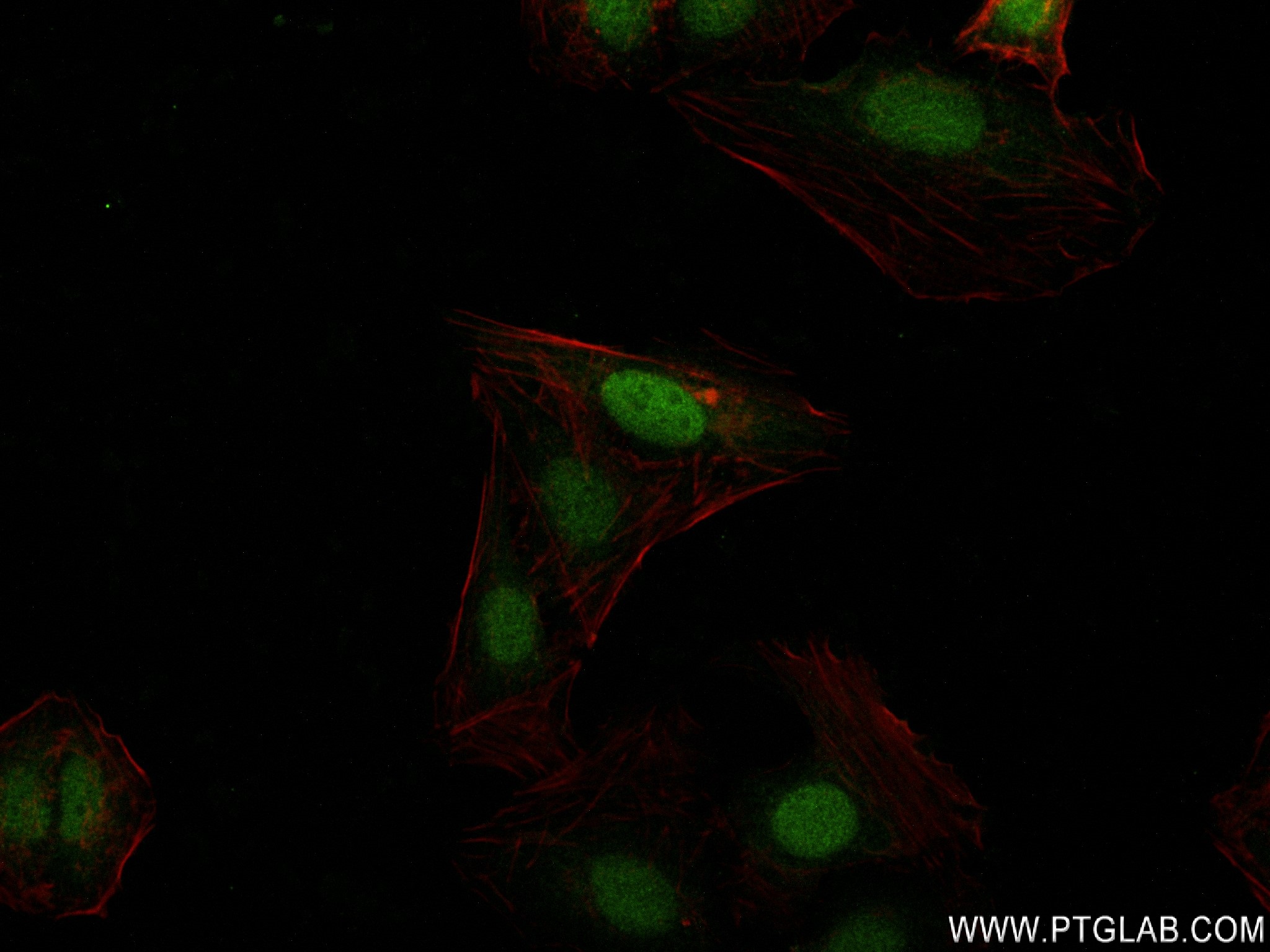 IF Staining of U2OS using 82898-1-RR (same clone as 82898-1-PBS)