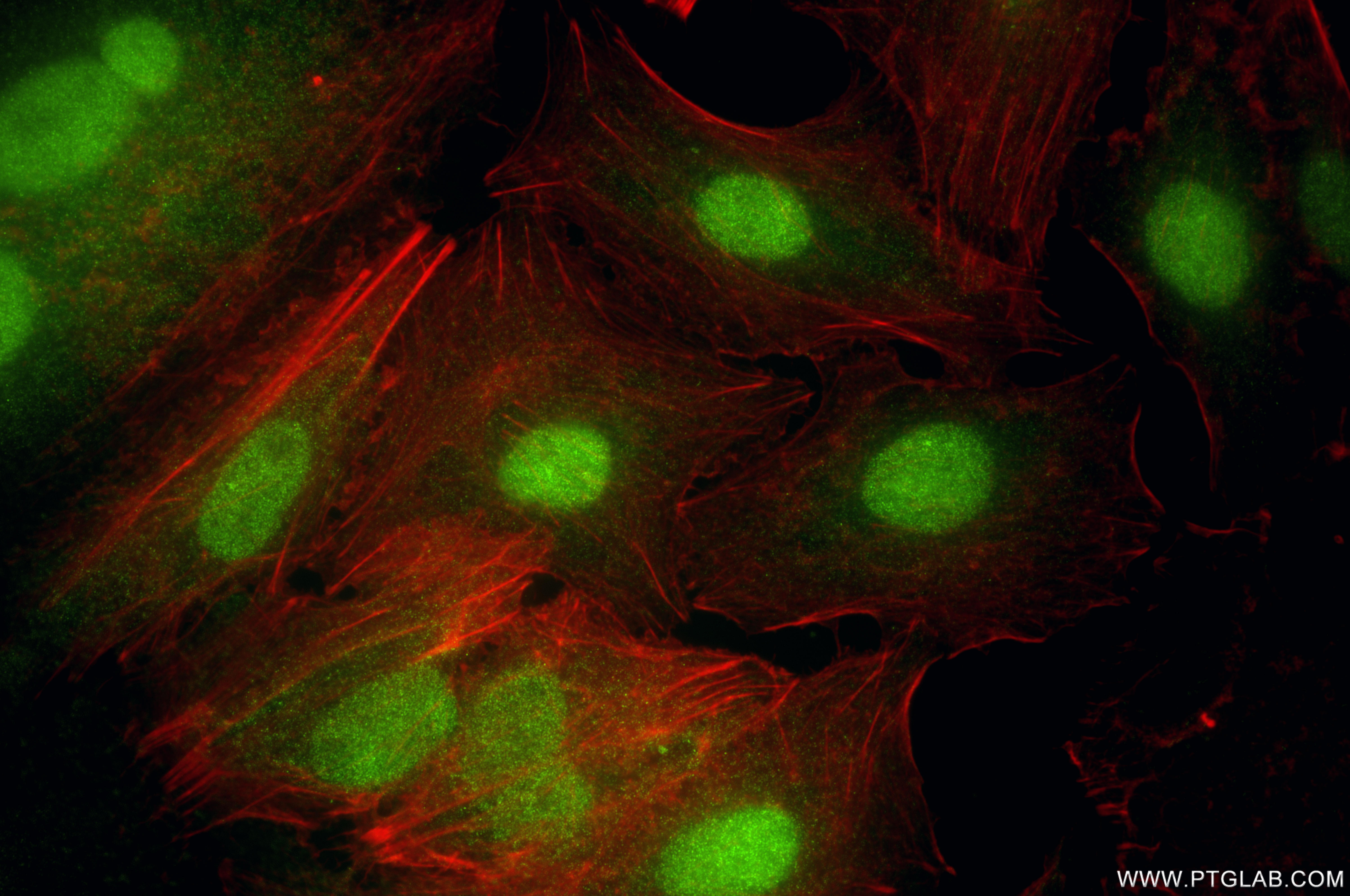 Immunofluorescent analysis of (4% PFA) fixed A549 cells using KPNA4 antibody (82898-1-RR, Clone: 230098H3 ) at dilution of 1:1000 and CoraLite®488-Conjugated Goat Anti-Rabbit IgG(H+L) (<a class='green' href='/productredirect?CatalogNo=SA00013-2' target='_blank'>SA00013-2</a>), CL594-Phalloidin (red). IF Staining of A549 using 82898-1-RR