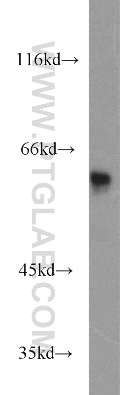 WB analysis of Jurkat using 13963-1-AP