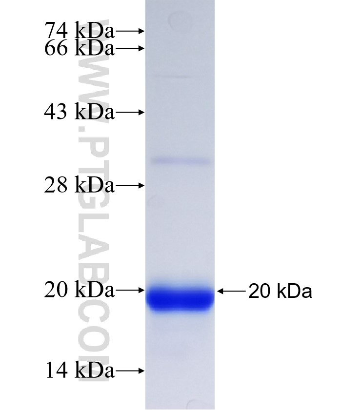 KPNA7 fusion protein Ag34000 SDS-PAGE KPNA7 fusion protein Ag34000 SDS-PAGE