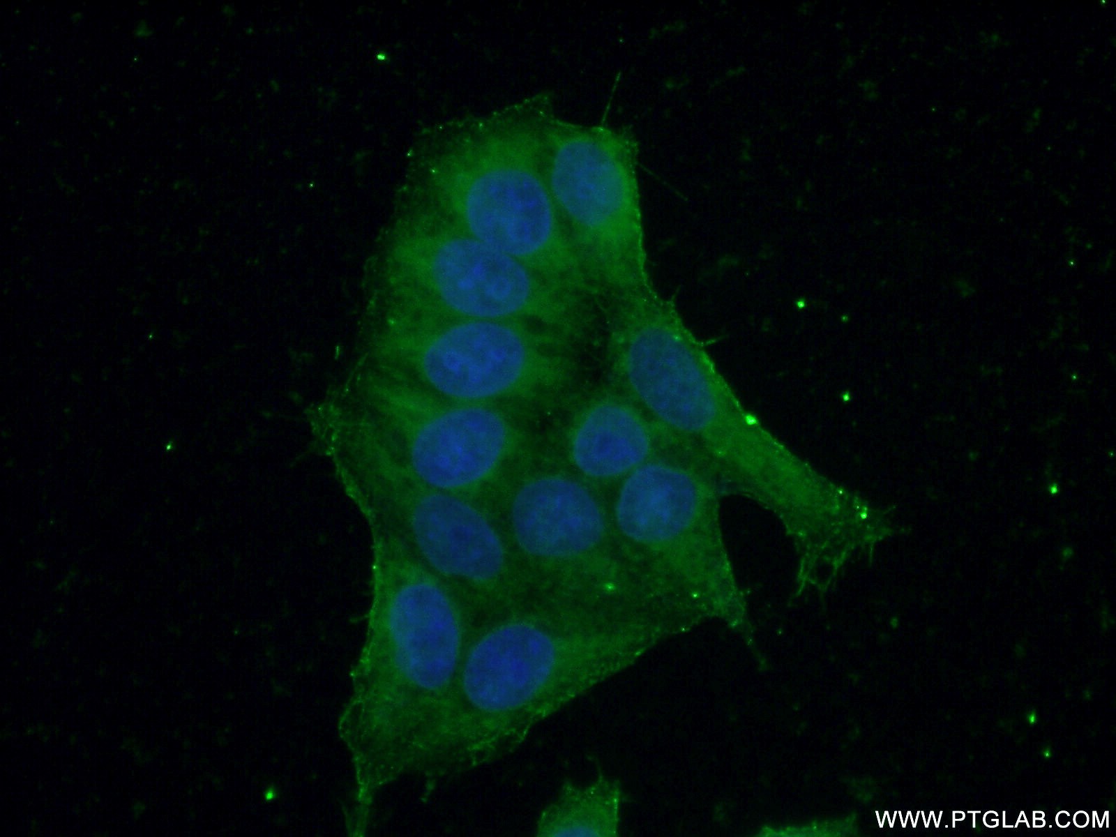 IF Staining of HeLa using 16094-1-AP