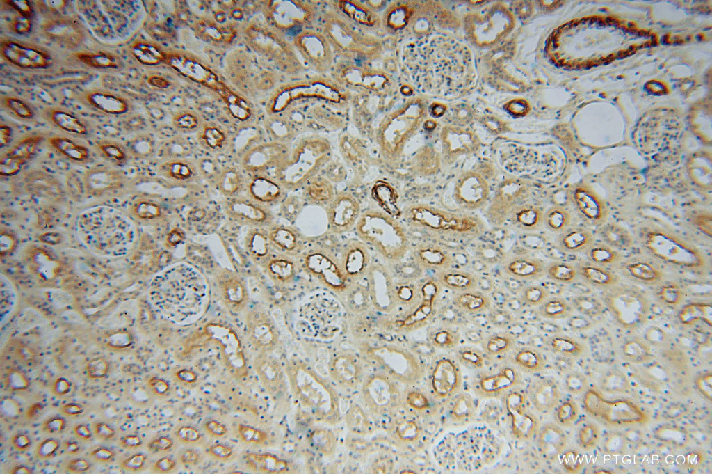 IHC staining of human kidney using 16094-1-AP