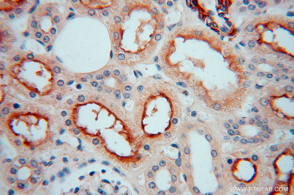 IHC staining of human kidney using 16094-1-AP