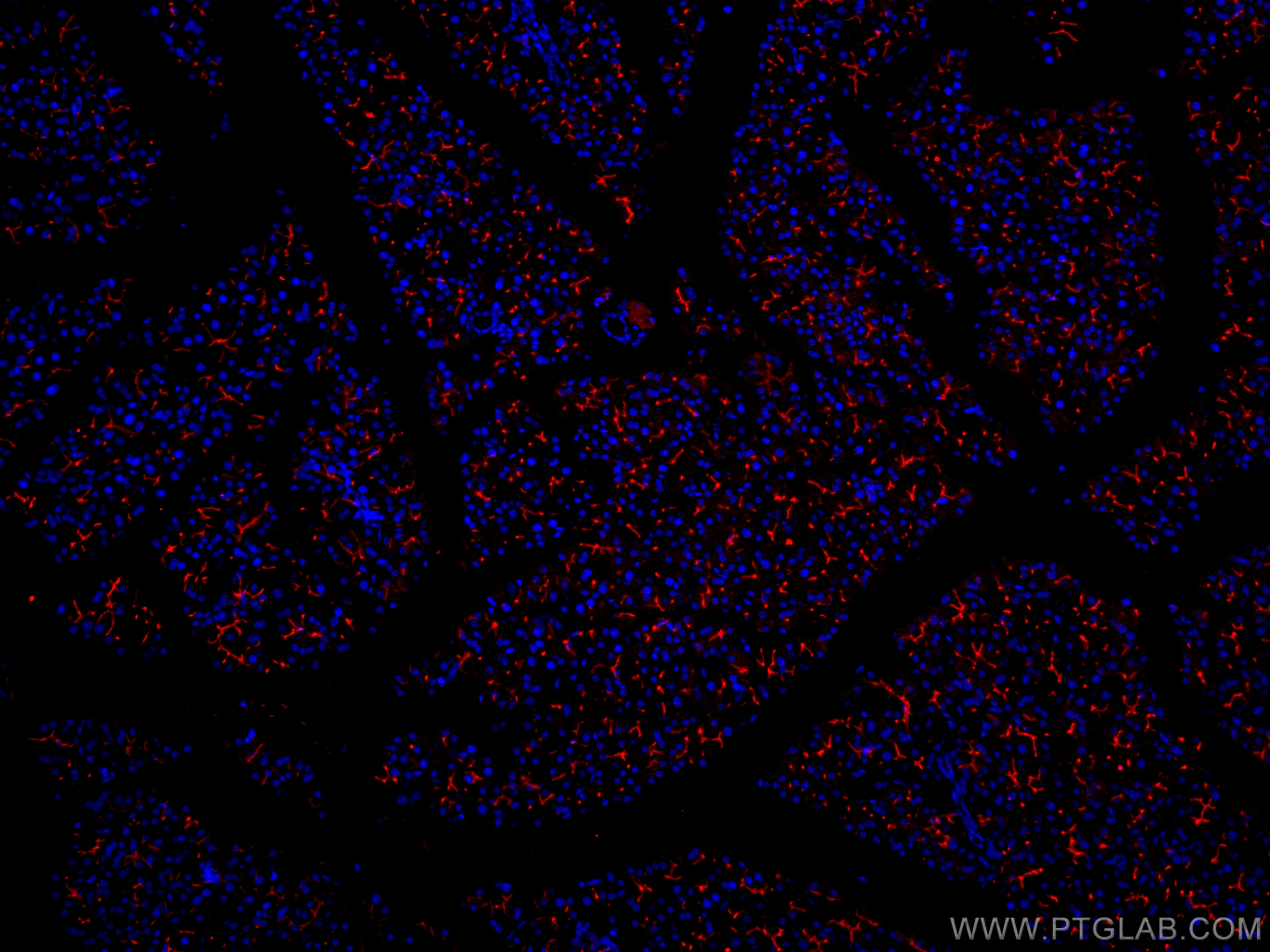 IF Staining of mouse pancreas using CL594-14157