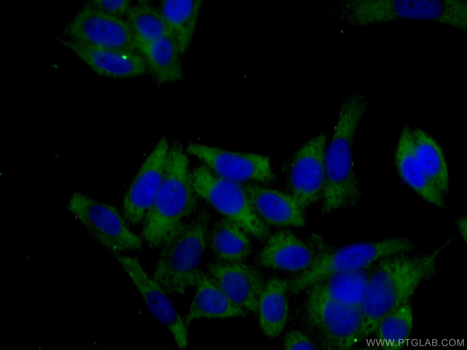 IF Staining of HeLa using 67266-1-Ig