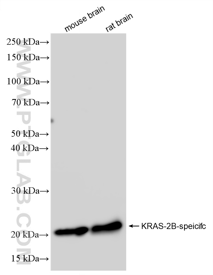 WB analysis using 88151-1-RR WB analysis using 88151-1-RR