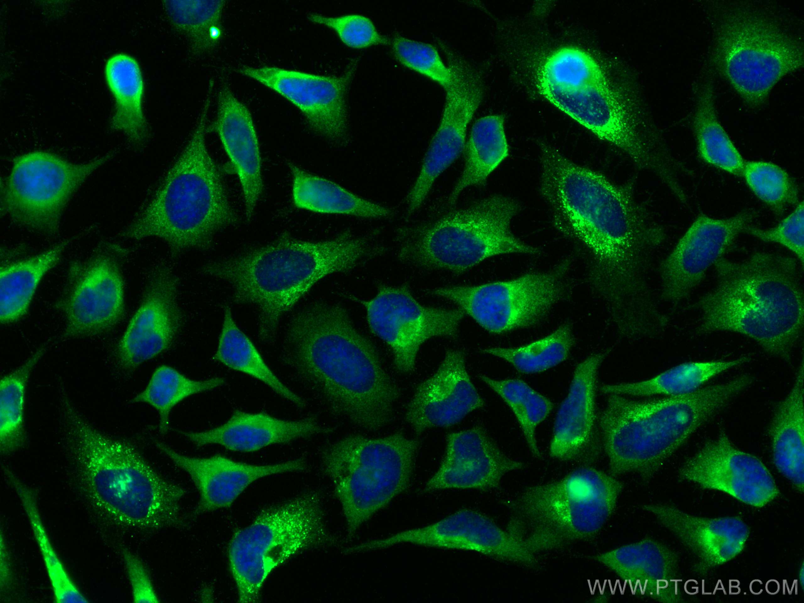 IF Staining of HeLa using 12063-1-AP