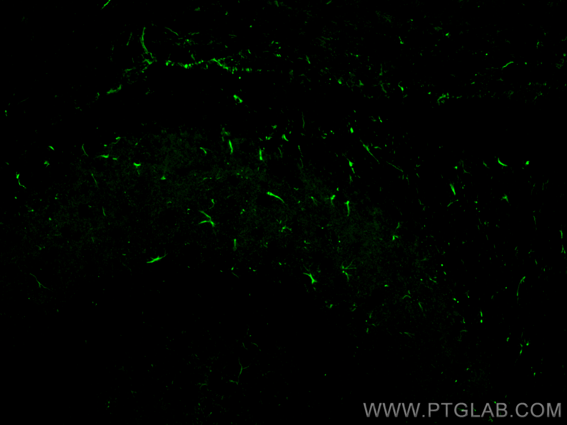 IF Staining of mouse brain using 12063-1-AP