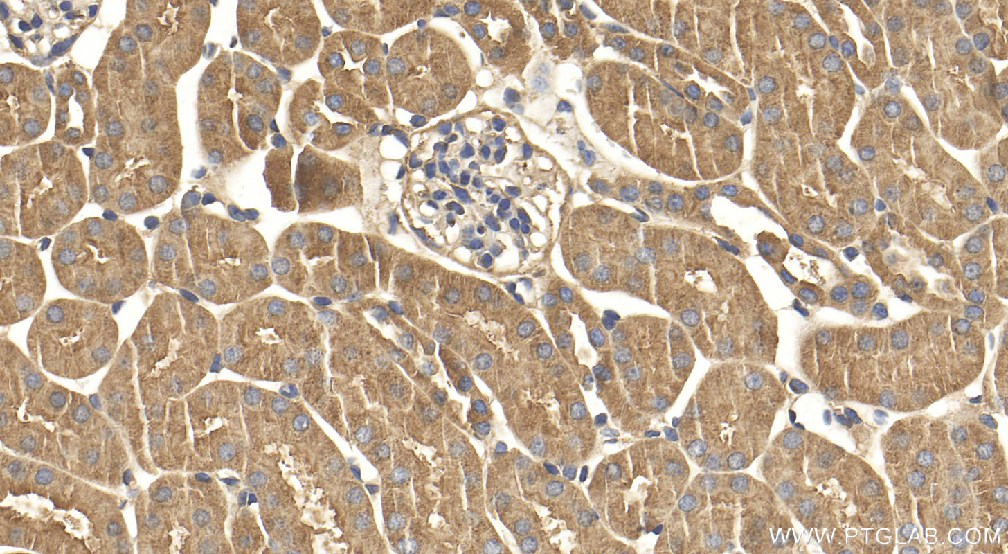 IHC staining of mouse kidney using 12063-1-AP