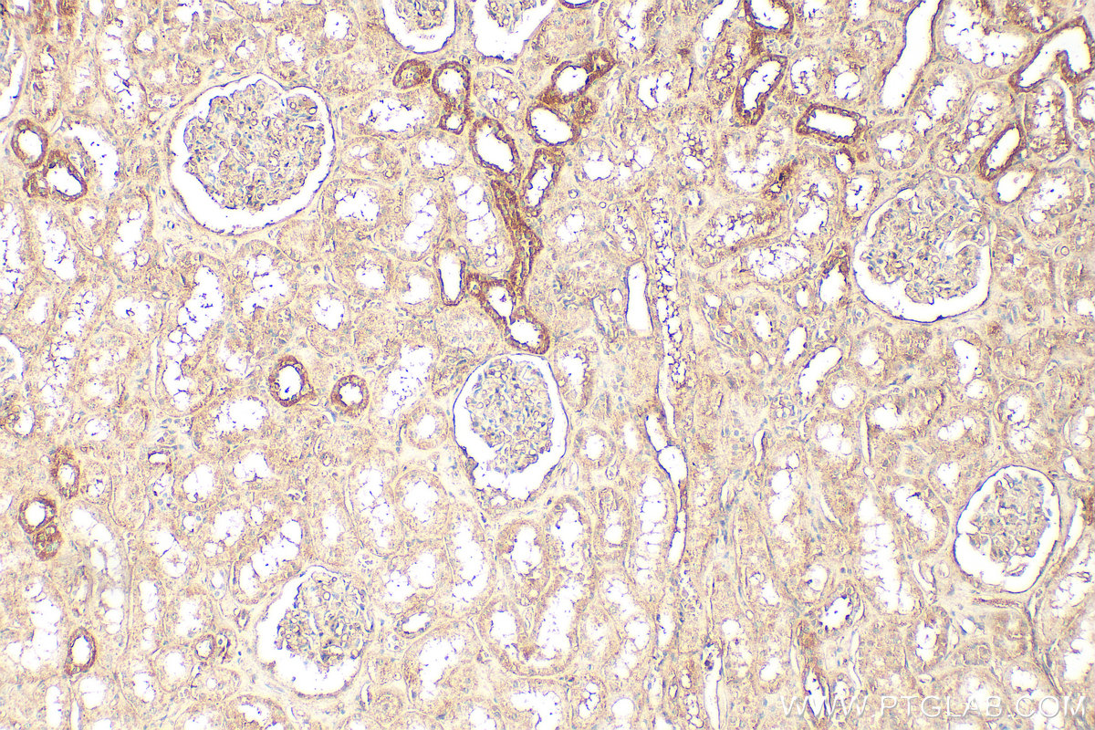 Immunohistochemical analysis of paraffin-embedded human kidney tissue slide using 12063-1-AP (KRAS antibody) at dilution of 1:200 (under 10x lens). Heat mediated antigen retrieval with Tris-EDTA buffer (pH 9.0). IHC staining of human kidney using 12063-1-AP