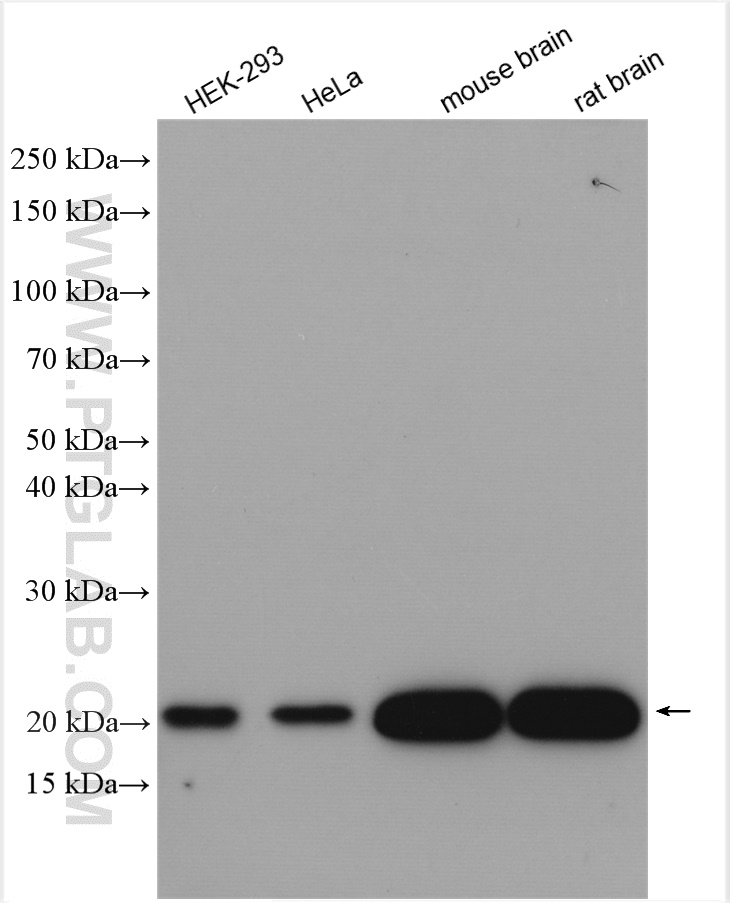 WB analysis using 12063-1-AP