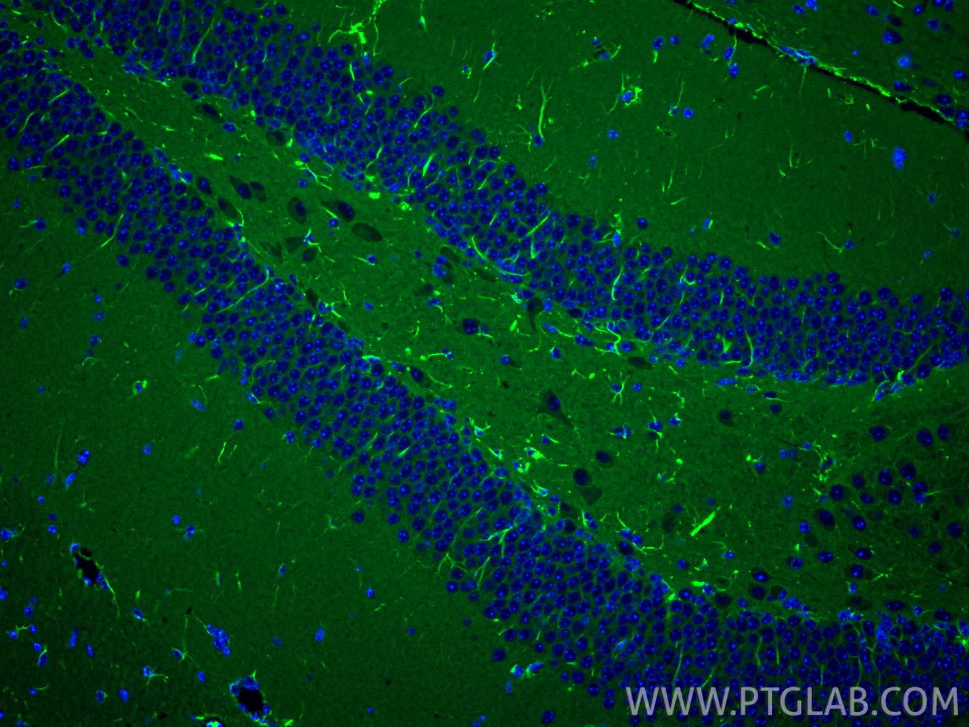 IF Staining of mouse brain using 60309-1-Ig