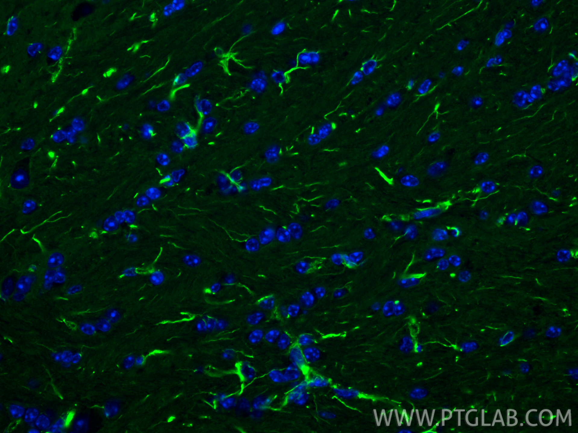 IF Staining of mouse brain using 60309-1-Ig