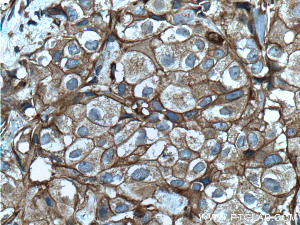 pan Ras Monoclonal antibody