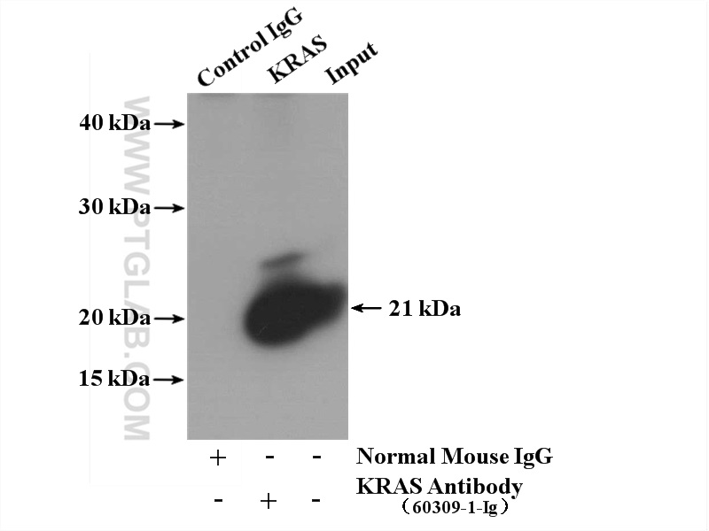 IP experiment of mouse brain using 60309-1-Ig