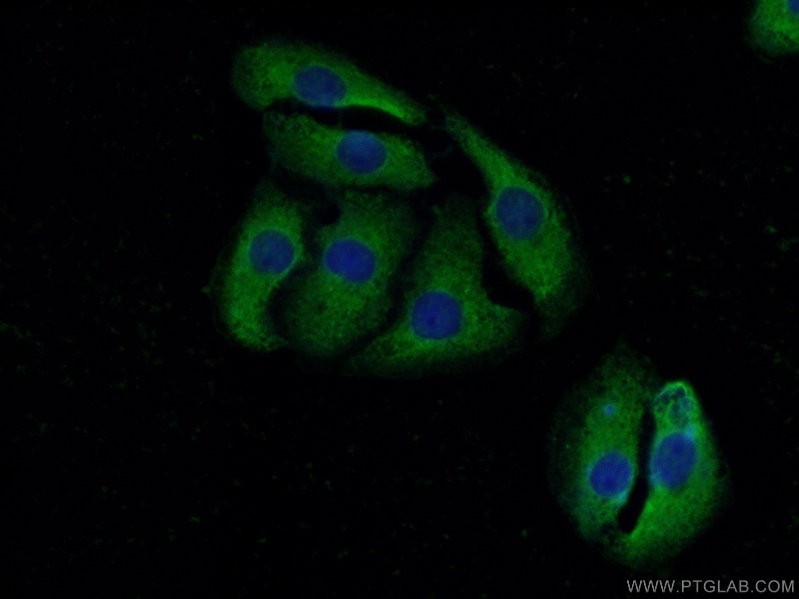 IF Staining of SH-SY5Y using 16156-1-AP