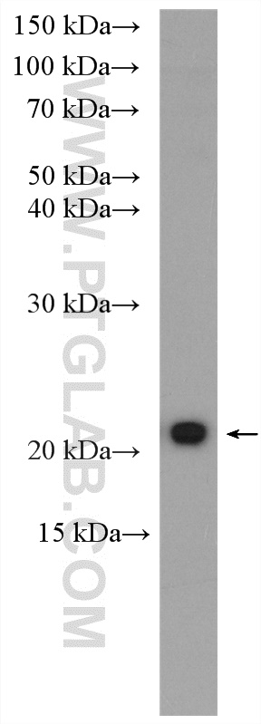 WB analysis of NIH/3T3 using 16156-1-AP