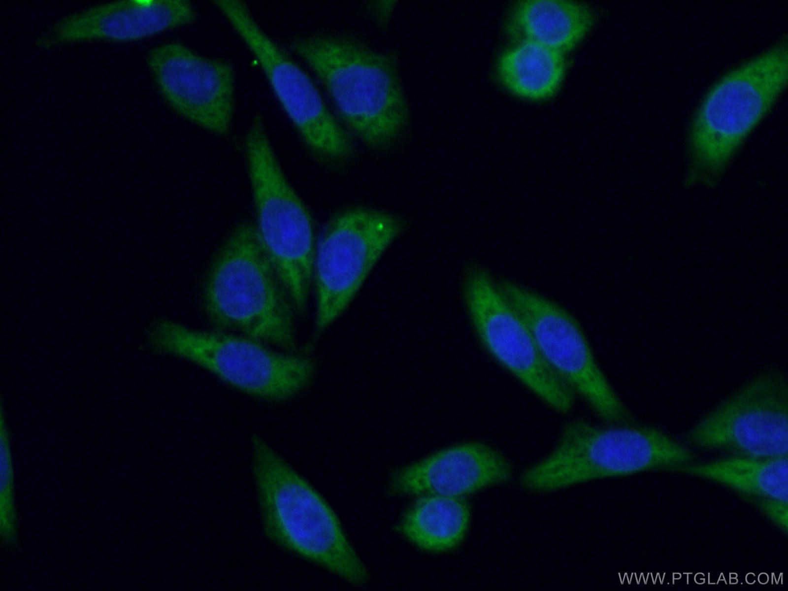IF Staining of HeLa using 16155-1-AP