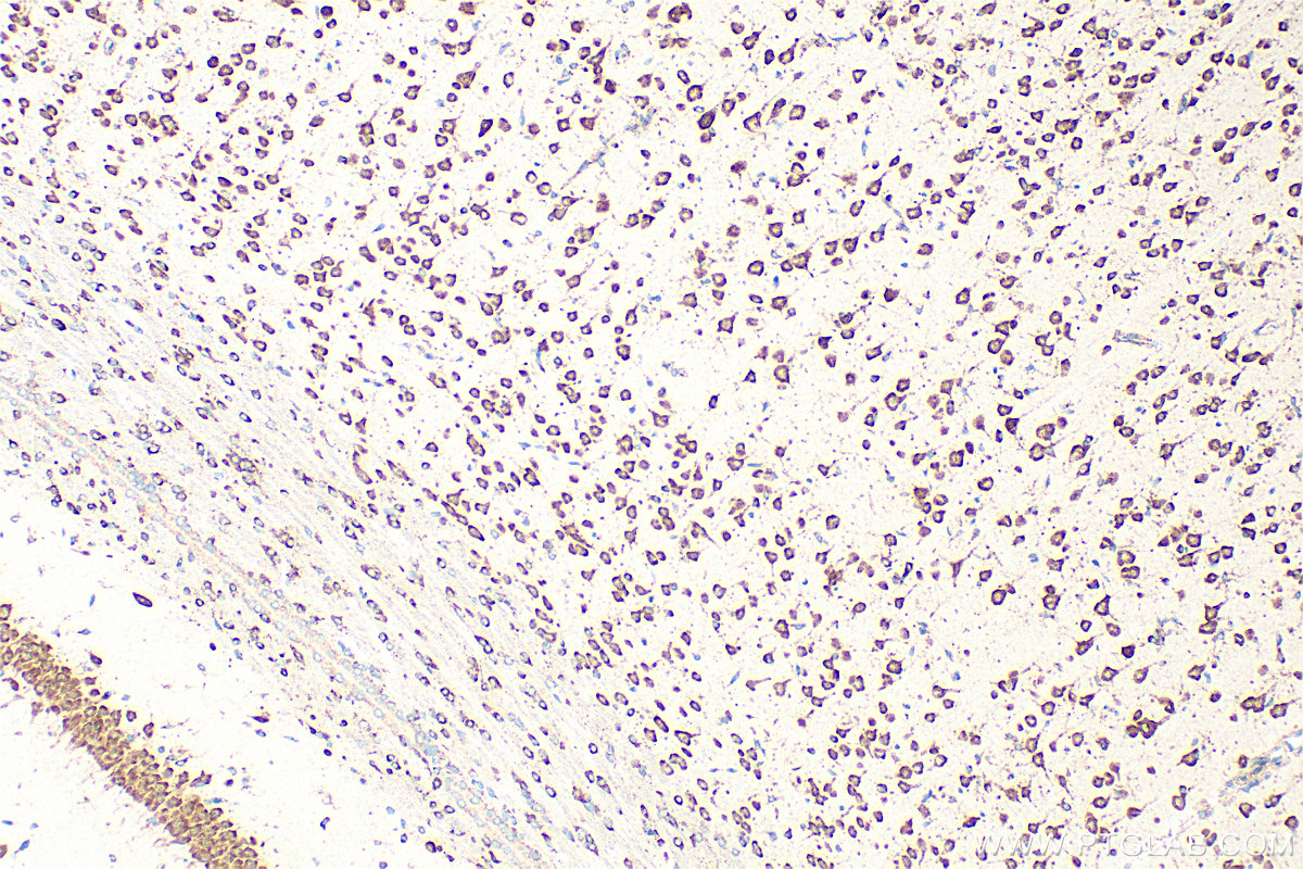 IHC staining of rat brain using 16155-1-AP
