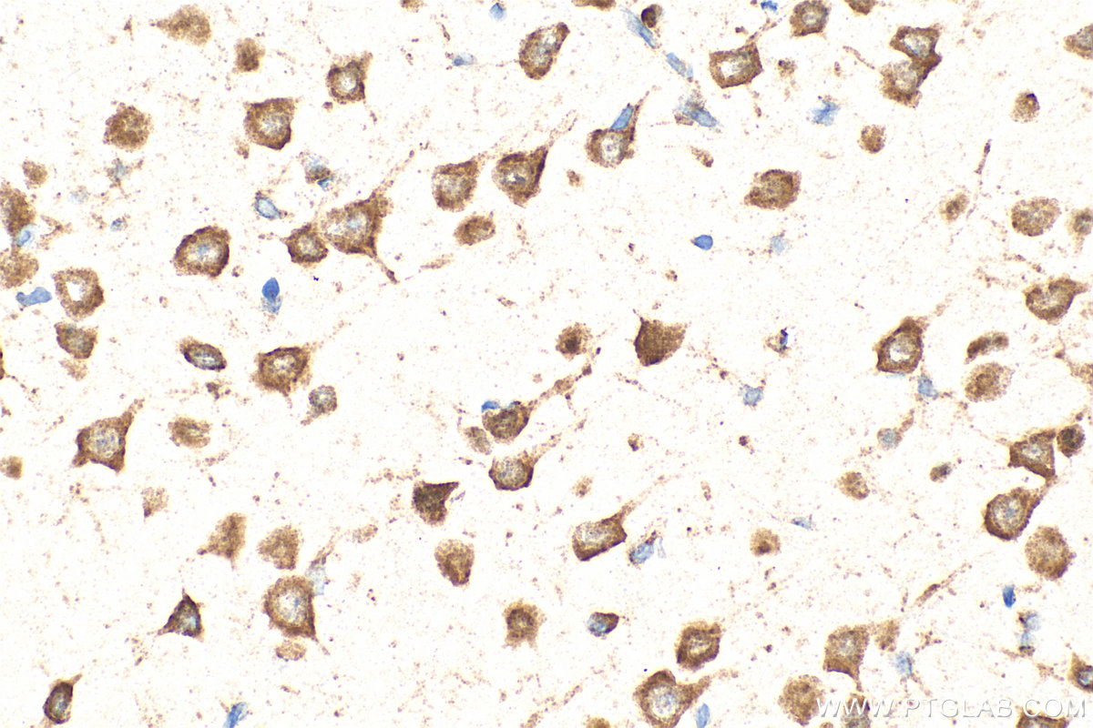 IHC staining of rat brain using 16155-1-AP