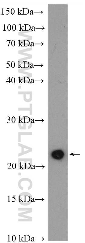 WB analysis of HeLa using 16155-1-AP