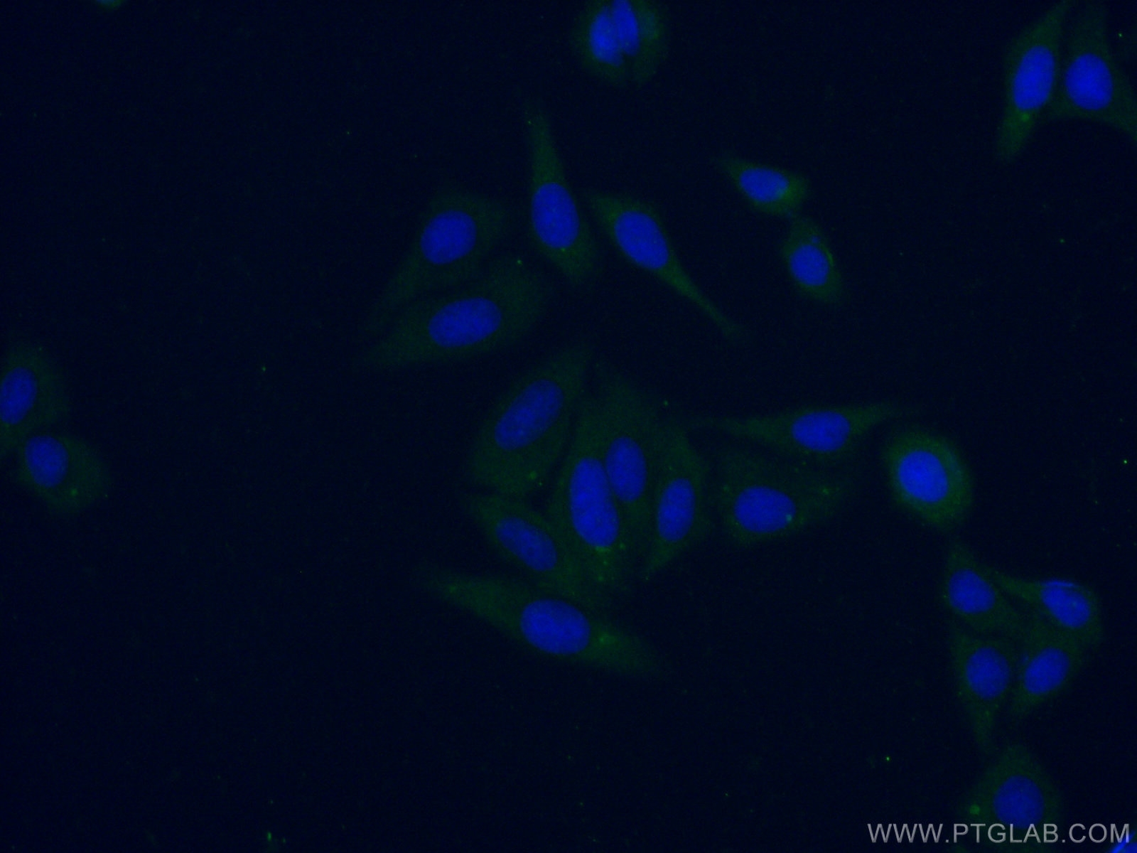 IF Staining of HepG2 using 16916-1-AP