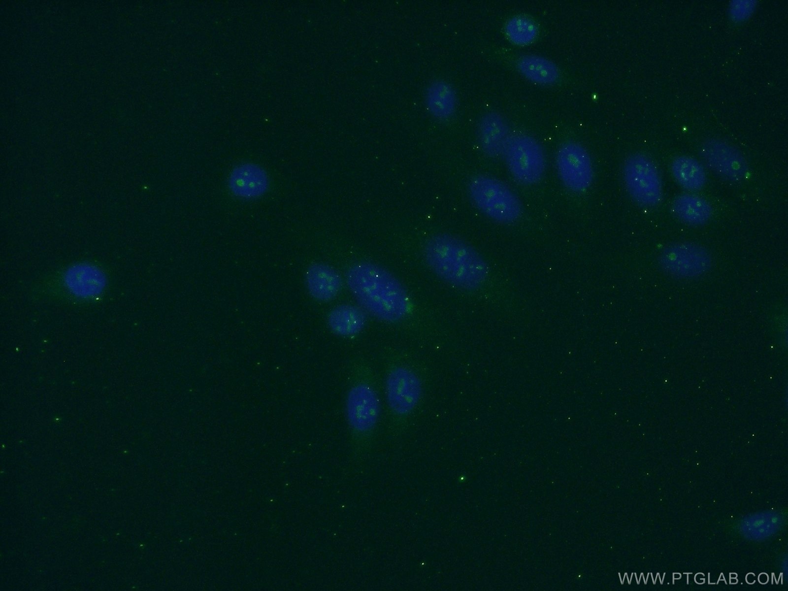 IF Staining of HepG2 using 16243-1-AP