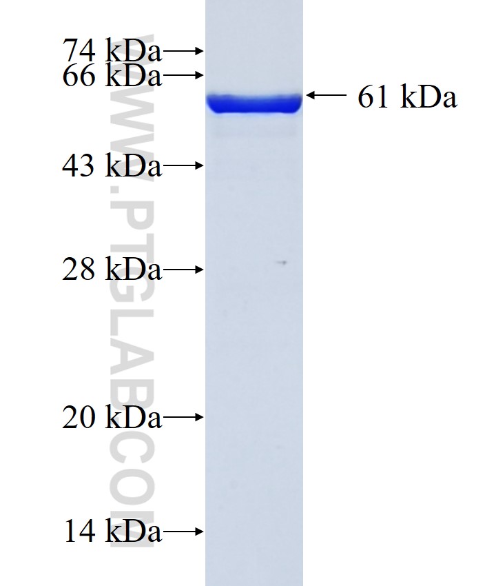 KRIT1 fusion protein Ag20061 SDS-PAGE KRIT1 fusion protein Ag20061 SDS-PAGE