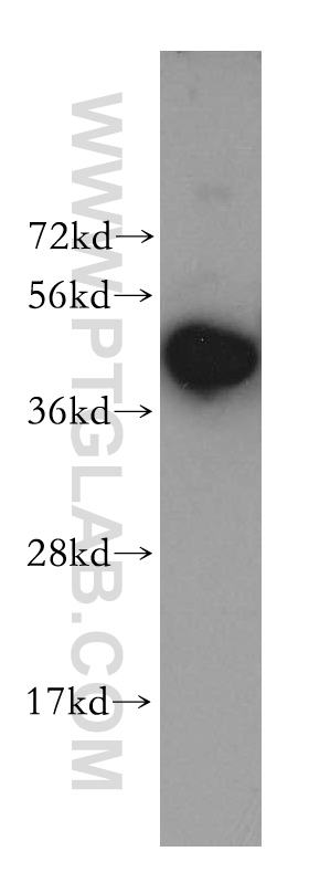 WB analysis of human brain using 12772-1-AP