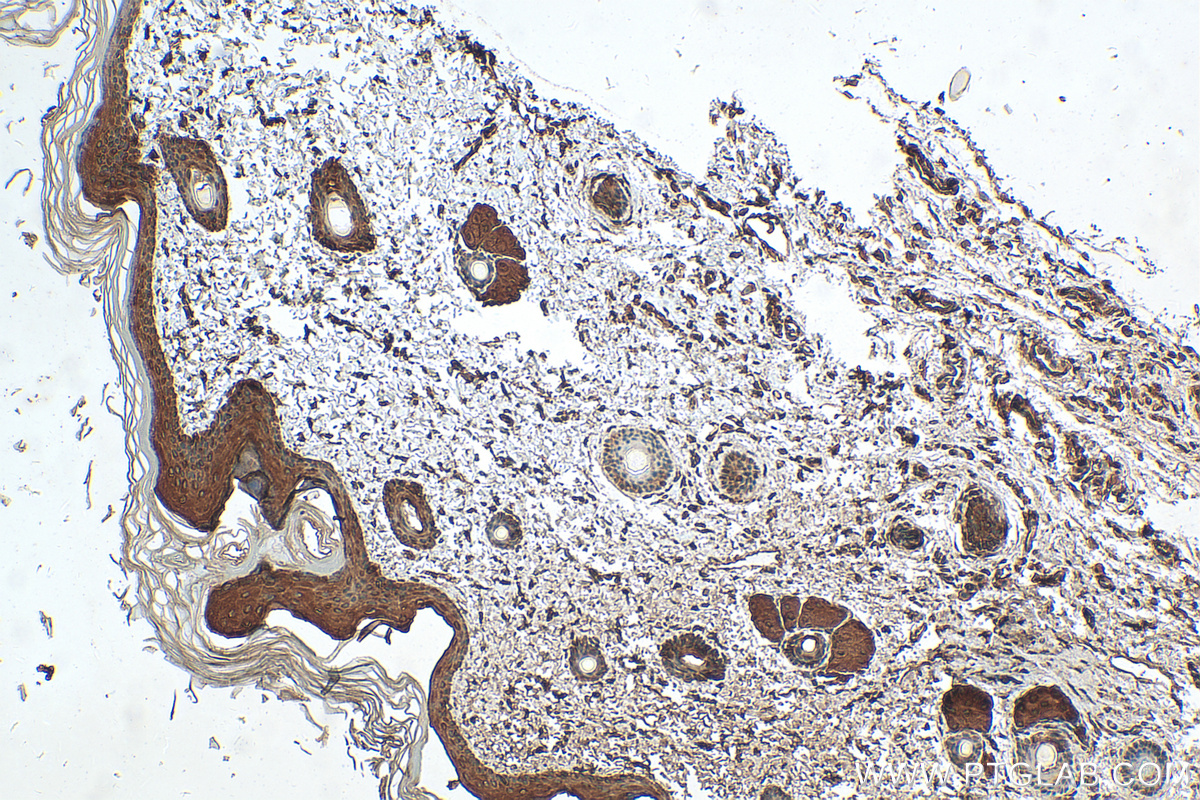 IHC staining of rat skin using 16848-1-AP