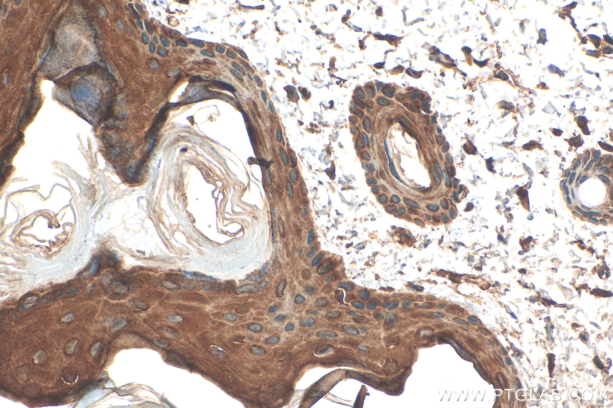 IHC staining of rat skin using 16848-1-AP