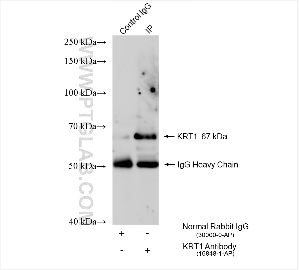 IP experiment of mouse skin using 16848-1-AP