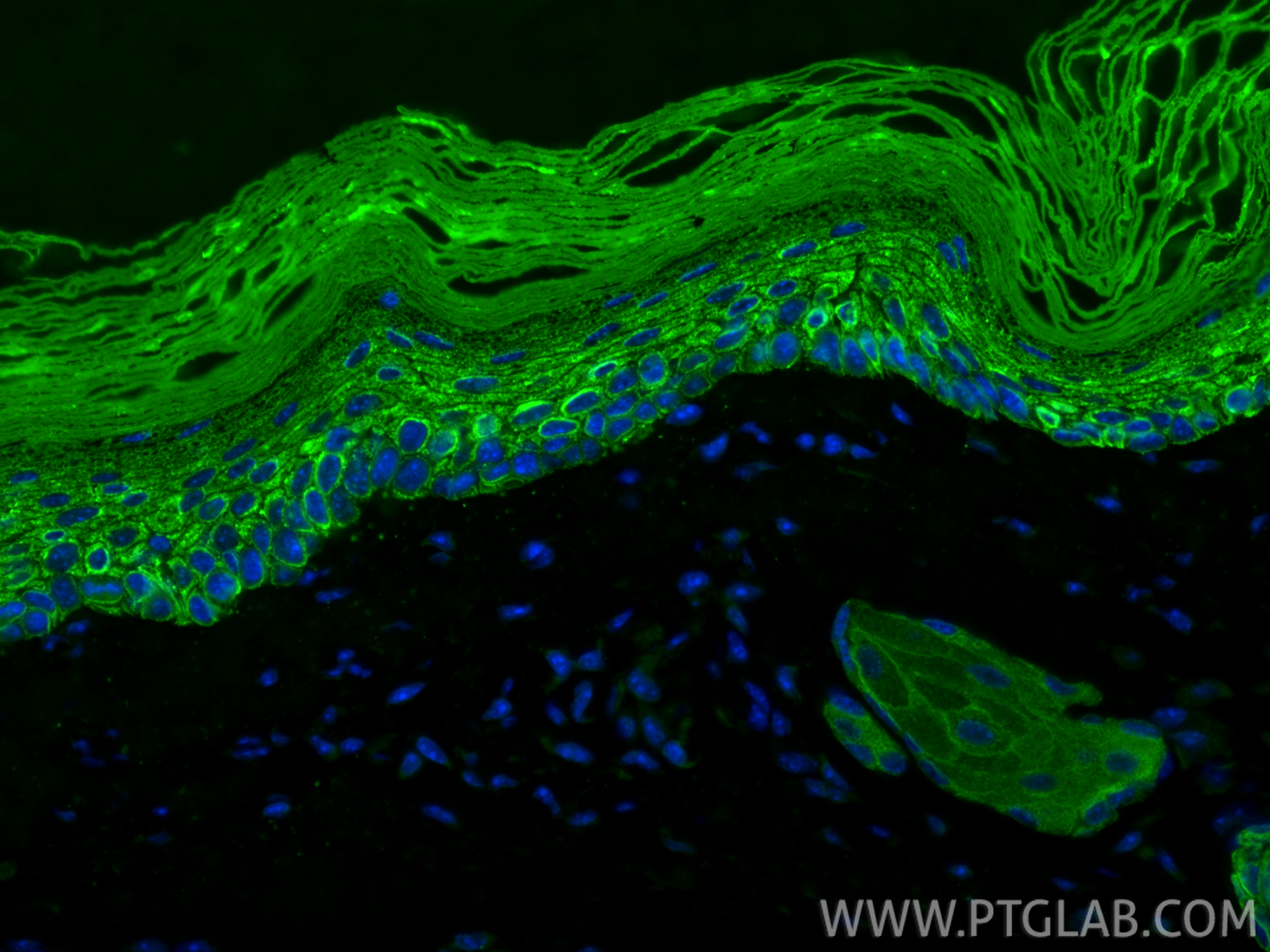 IF Staining of mouse skin using 18343-1-AP