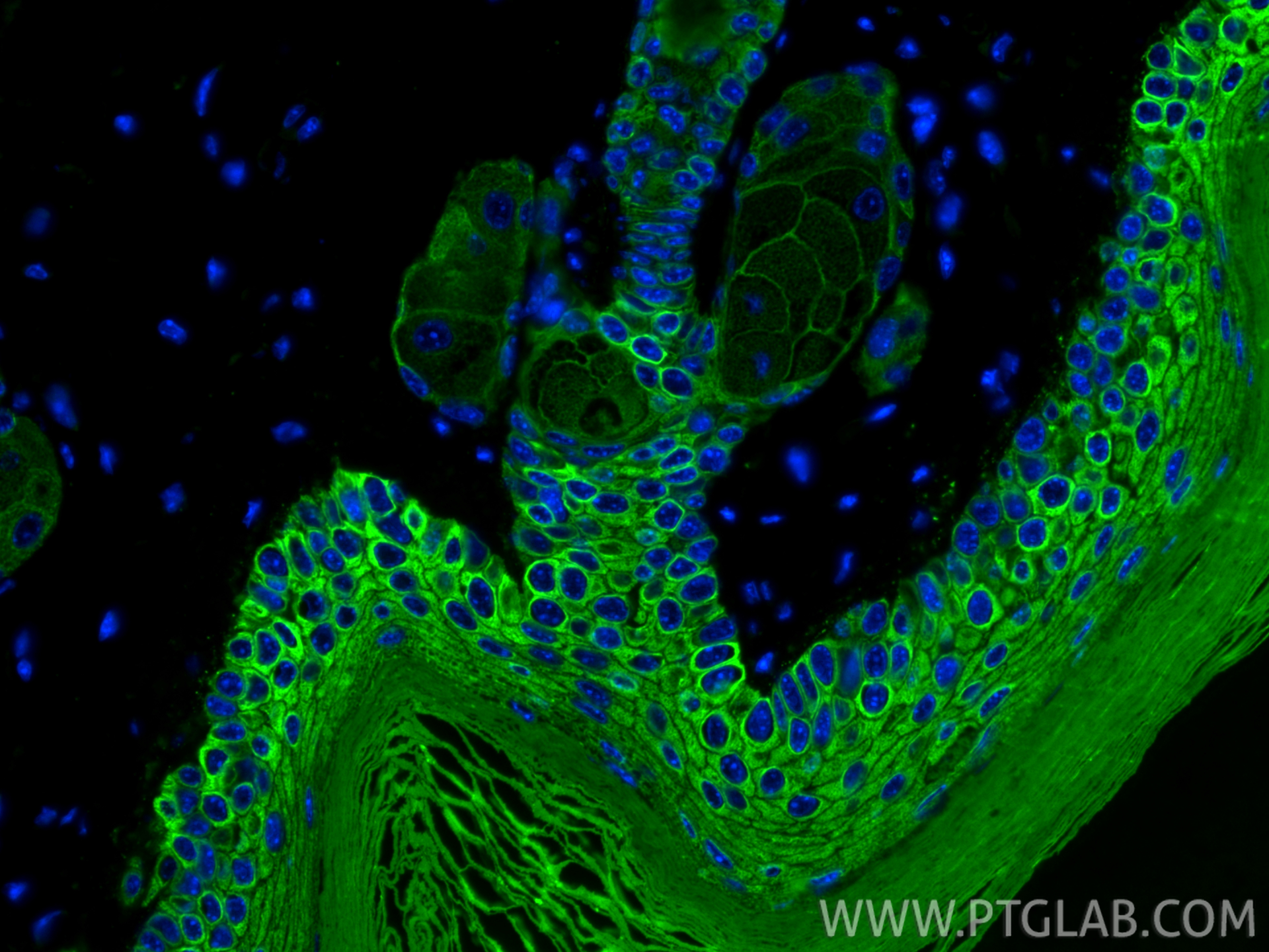 IF Staining of mouse skin using 18343-1-AP