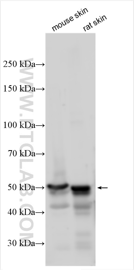 WB analysis using 18343-1-AP