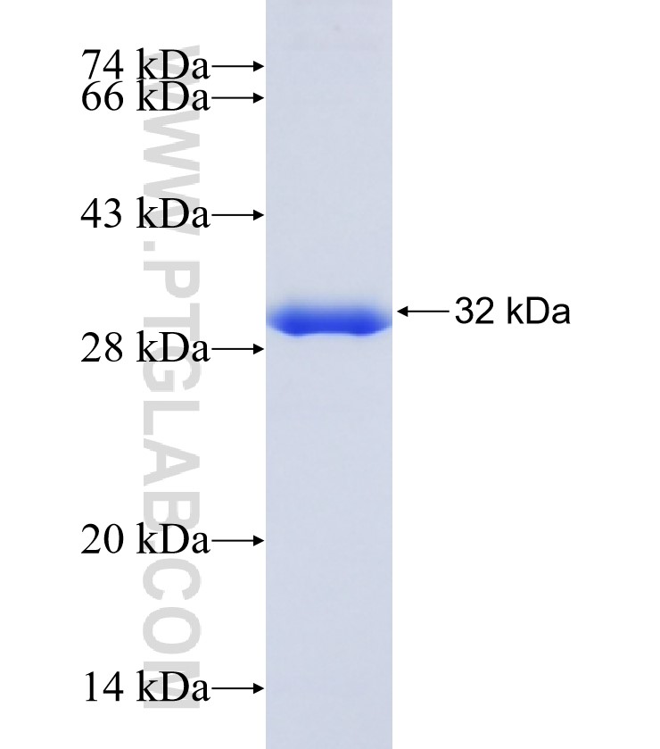 KRT10 fusion protein Ag12729 SDS-PAGE KRT10 fusion protein Ag12729 SDS-PAGE
