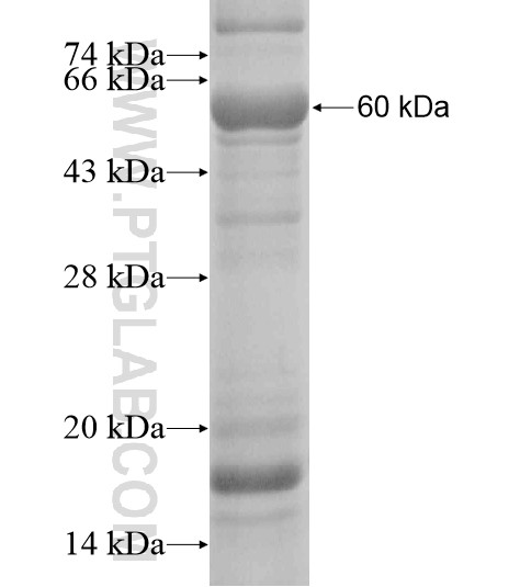 KRT10 fusion protein Ag20209 SDS-PAGE