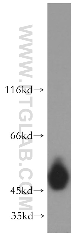 WB analysis of A431 using 10143-1-AP