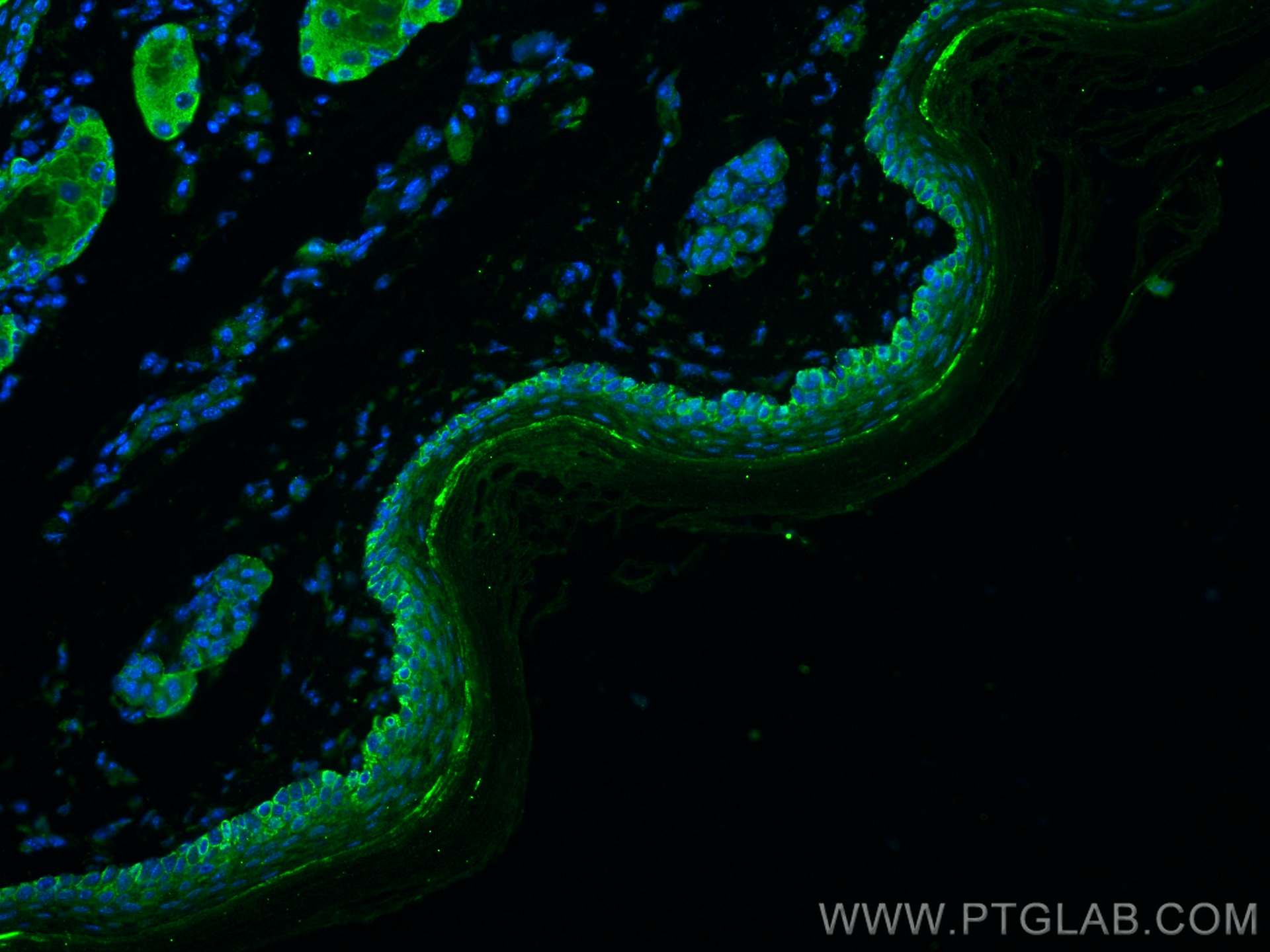 IF Staining of mouse skin using 22221-1-AP