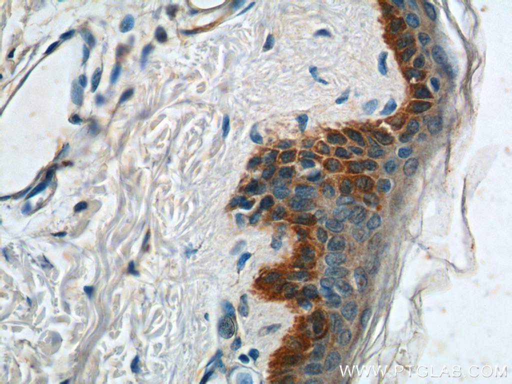 IHC staining of human skin using 22221-1-AP