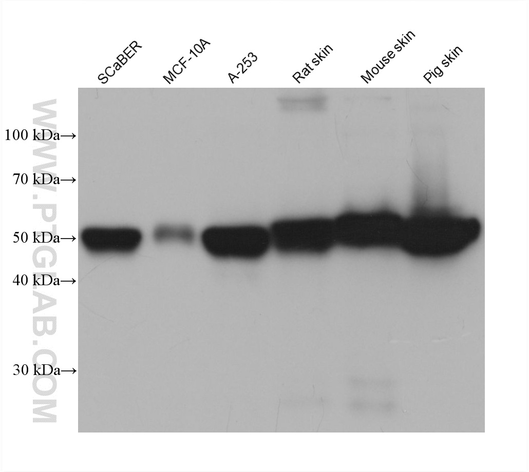 WB analysis using 60320-1-Ig WB analysis using 60320-1-Ig