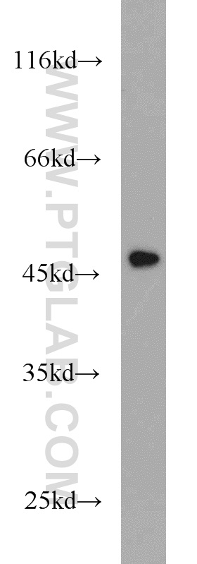 Cytokeratin 15 Polyclonal antibody