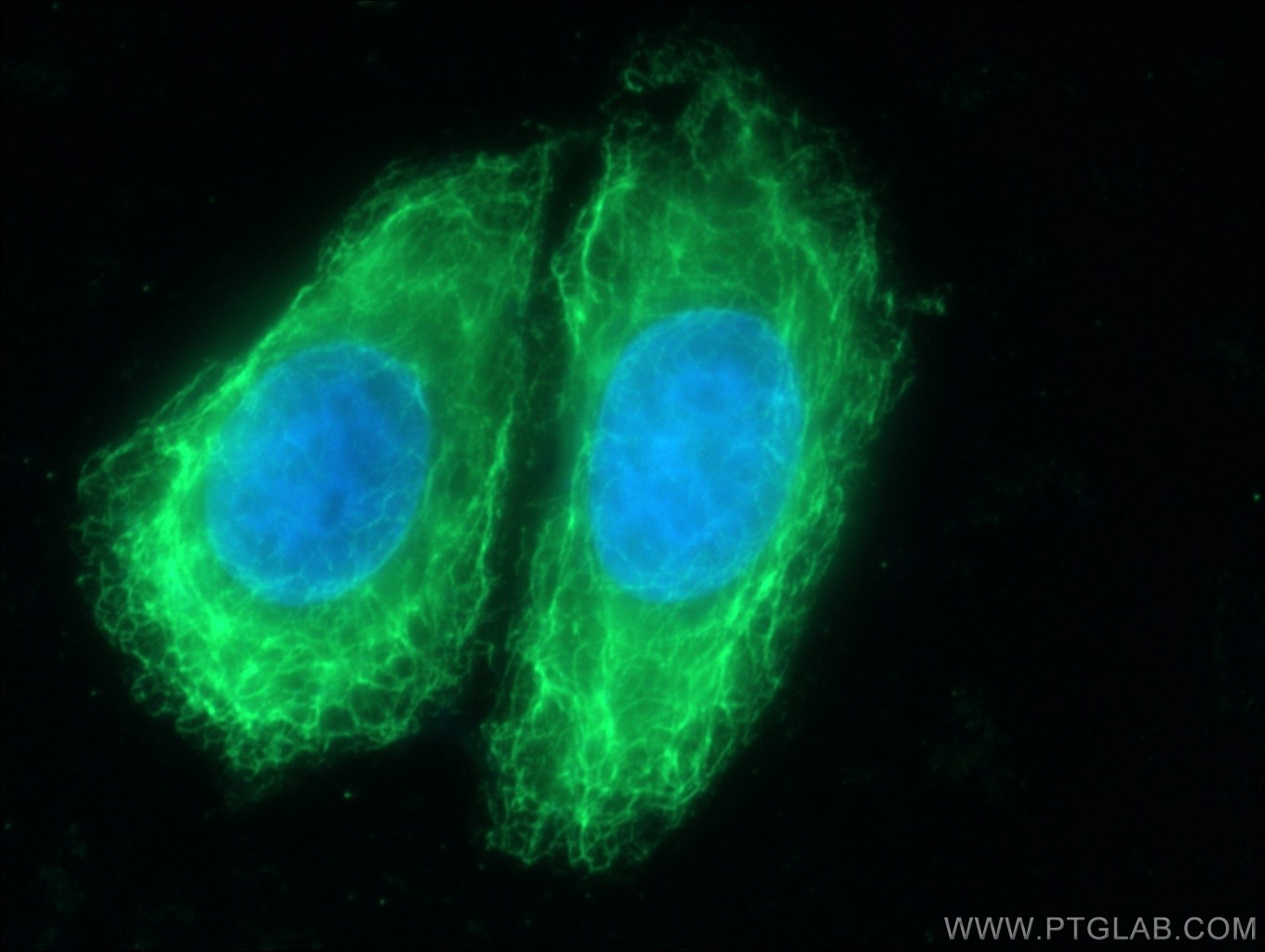 IF Staining of HeLa using 60247-1-Ig (same clone as 60247-1-PBS)