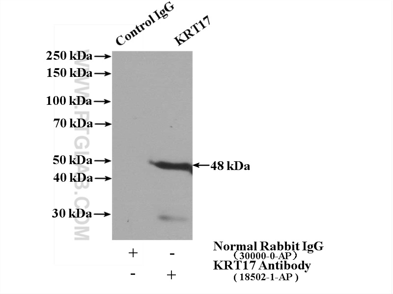 IP experiment of HeLa using 18502-1-AP